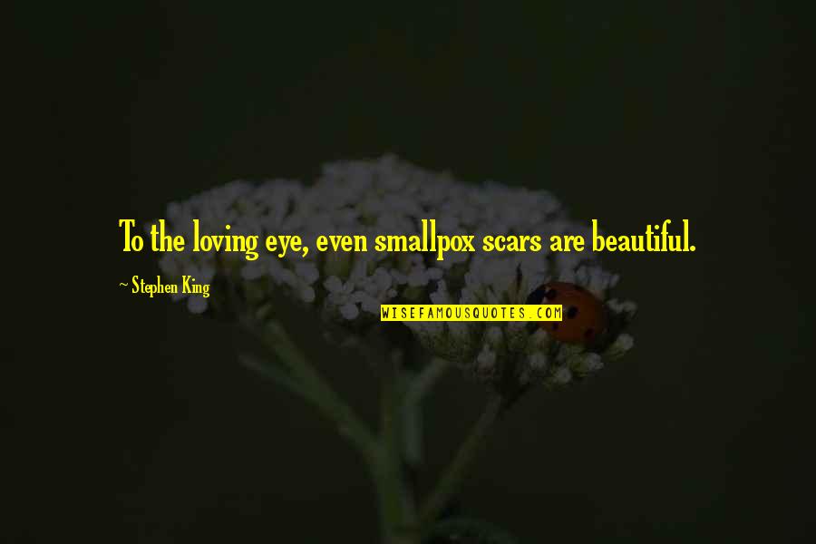 Loving You Is Beautiful Quotes By Stephen King: To the loving eye, even smallpox scars are