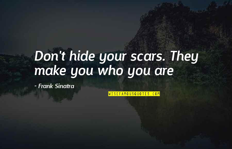 Lovitura Mortala Quotes By Frank Sinatra: Don't hide your scars. They make you who