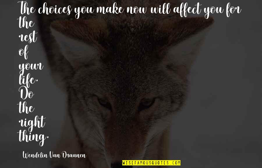 Make Sure You Rest Quotes By Wendelin Van Draanen: The choices you make now will affect you Make Sure You Rest Quotes By Wendelin Van Draanen: The choices you make now will affect you