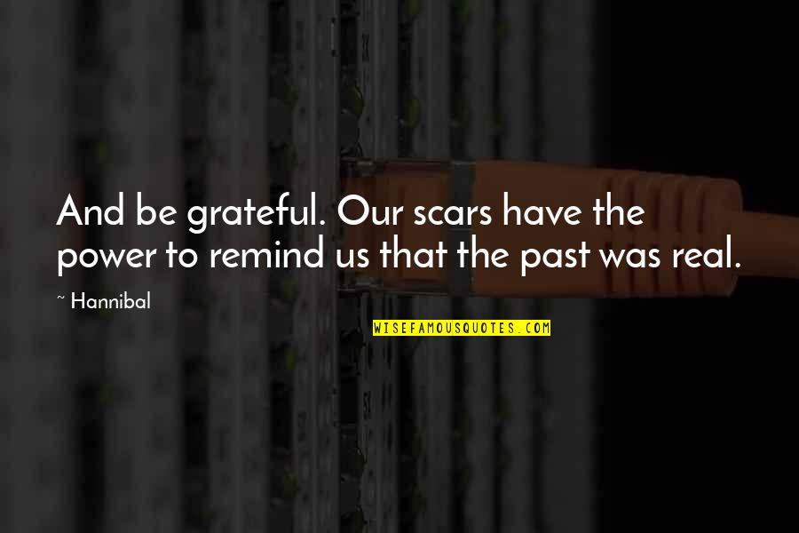 Mauris School Quotes By Hannibal: And be grateful. Our scars have the power