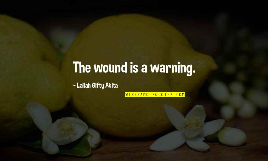 Mogomotsi Quotes By Lailah Gifty Akita: The wound is a warning. Mogomotsi Quotes By Lailah Gifty Akita: The wound is a warning.