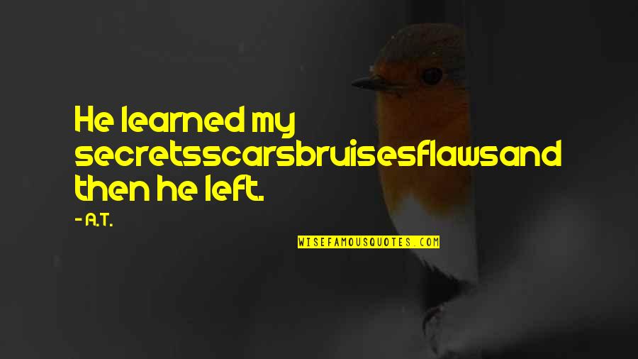 My Flaws Quotes By A.T.: He learned my secretsscarsbruisesflawsand then he left.