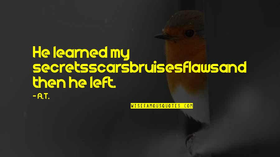 My Scars Quotes By A.T.: He learned my secretsscarsbruisesflawsand then he left.