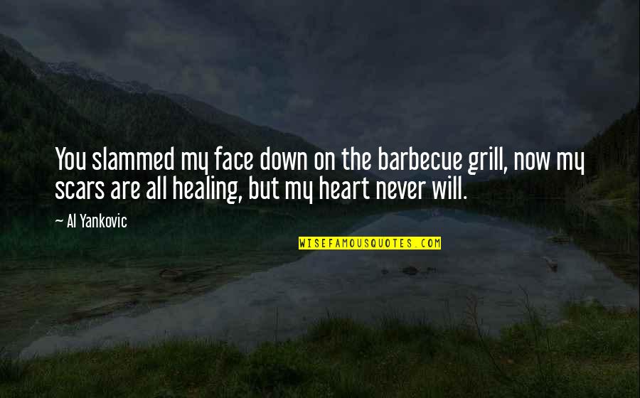 My Scars Quotes By Al Yankovic: You slammed my face down on the barbecue