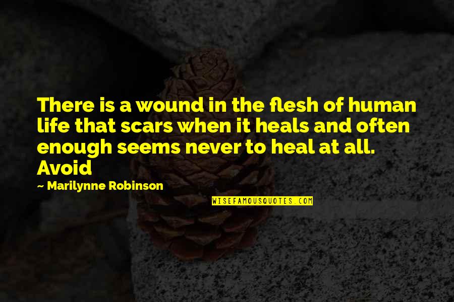 Never Avoid Quotes By Marilynne Robinson: There is a wound in the flesh of