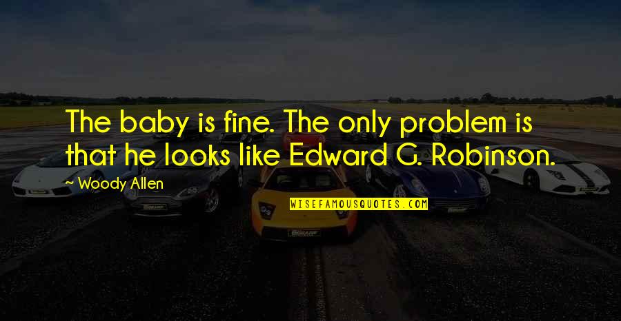 Nsfas Quotes By Woody Allen: The baby is fine. The only problem is