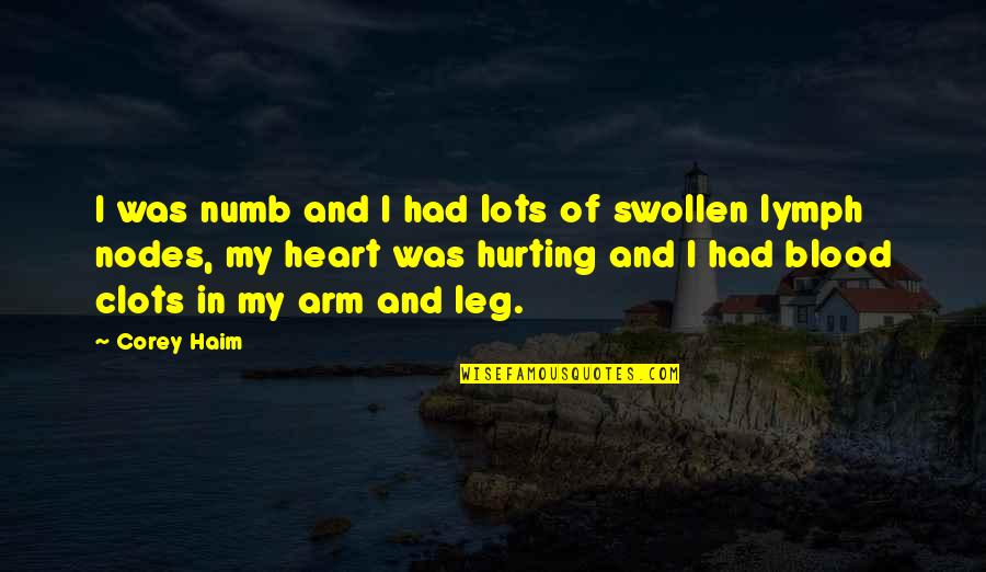 Numb Heart Quotes By Corey Haim: I was numb and I had lots of Numb Heart Quotes By Corey Haim: I was numb and I had lots of