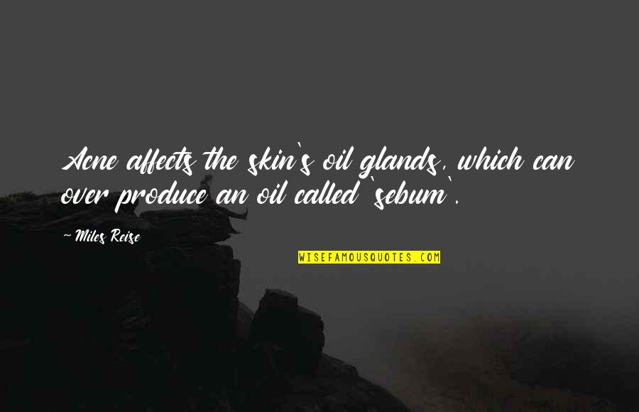 Oil Can Quotes By Miles Reise: Acne affects the skin's oil glands, which can