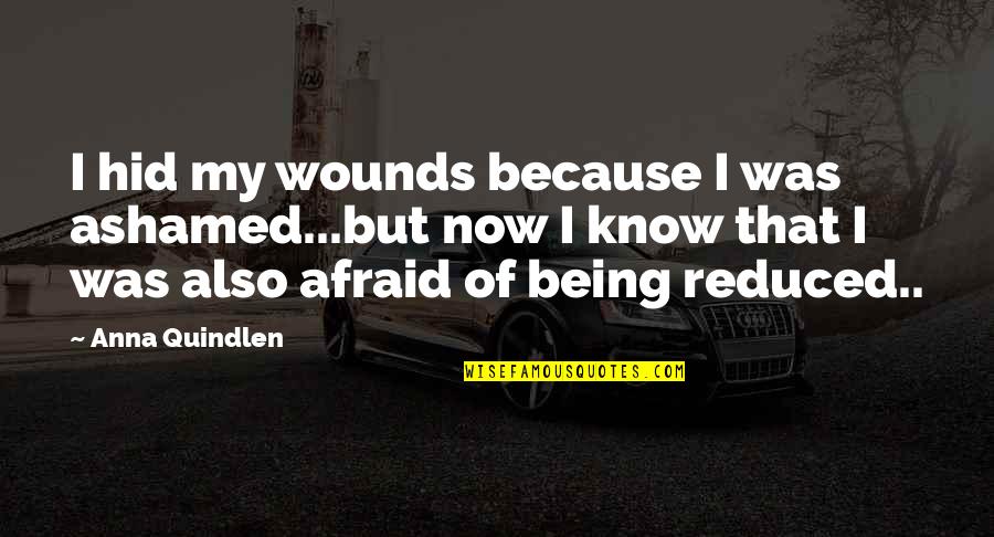 Quindlen Anna Quotes By Anna Quindlen: I hid my wounds because I was ashamed...but Quindlen Anna Quotes By Anna Quindlen: I hid my wounds because I was ashamed...but