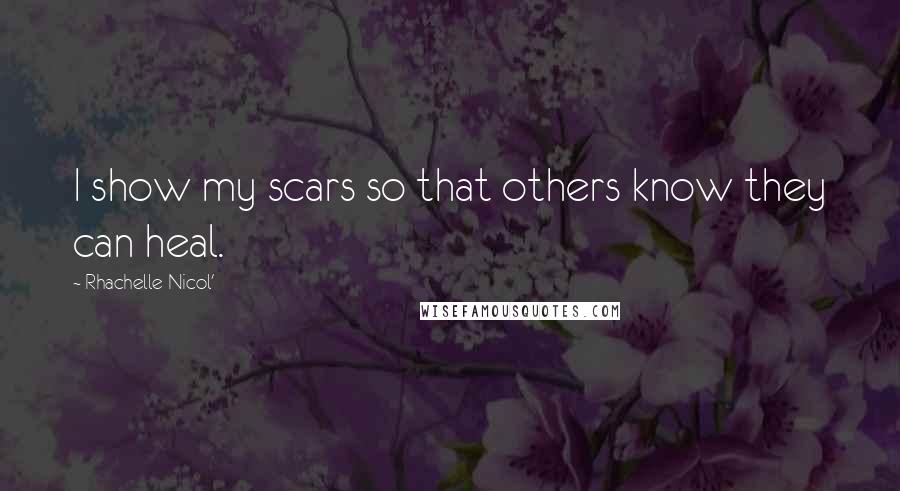 Rhachelle Nicol' quotes: I show my scars so that others know they can heal.