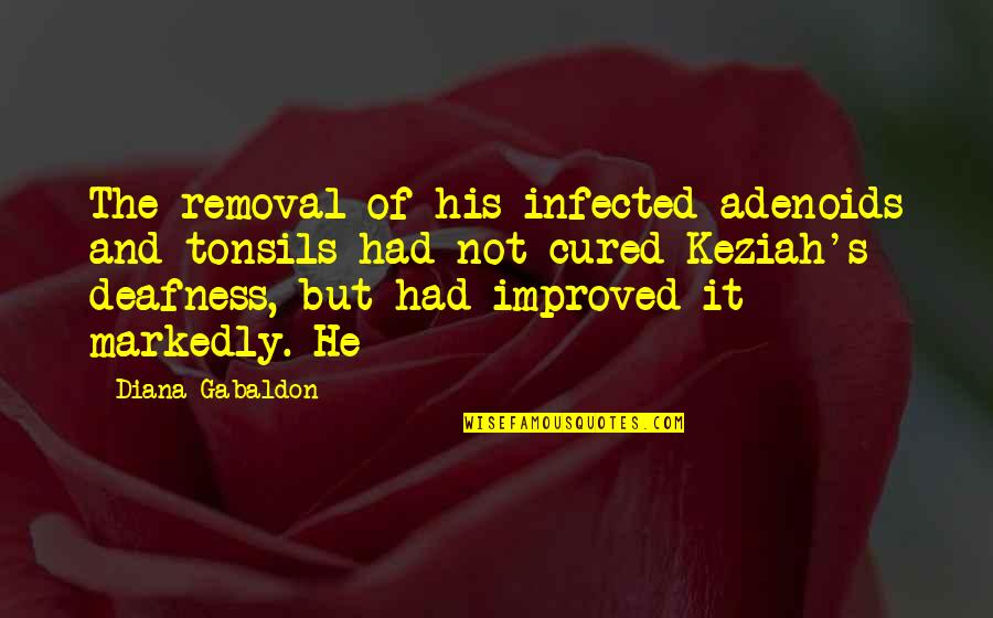 Ridinger Property Quotes By Diana Gabaldon: The removal of his infected adenoids and tonsils