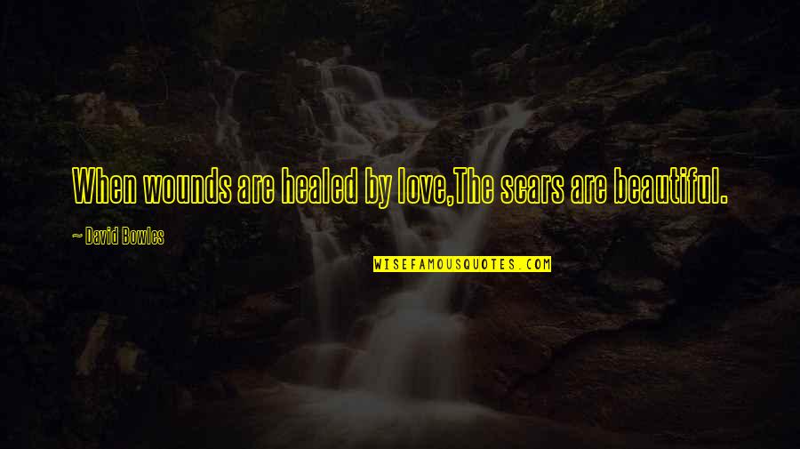 Robert E Lee By Presidents Quotes By David Bowles: When wounds are healed by love,The scars are Robert E Lee By Presidents Quotes By David Bowles: When wounds are healed by love,The scars are