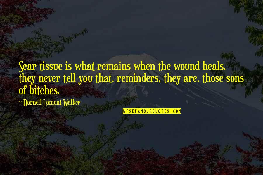 Rorick Fink Quotes By Darnell Lamont Walker: Scar tissue is what remains when the wound Rorick Fink Quotes By Darnell Lamont Walker: Scar tissue is what remains when the wound
