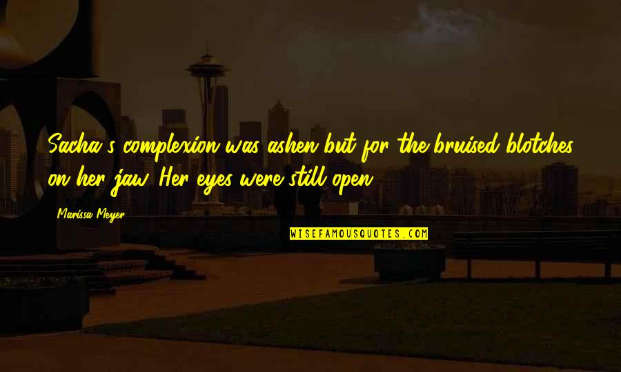 Sacha's Quotes By Marissa Meyer: Sacha's complexion was ashen but for the bruised Sacha's Quotes By Marissa Meyer: Sacha's complexion was ashen but for the bruised