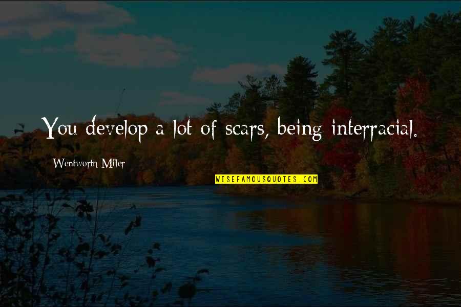 Sad Lonely Broken Heart Quotes By Wentworth Miller: You develop a lot of scars, being interracial. Sad Lonely Broken Heart Quotes By Wentworth Miller: You develop a lot of scars, being interracial.