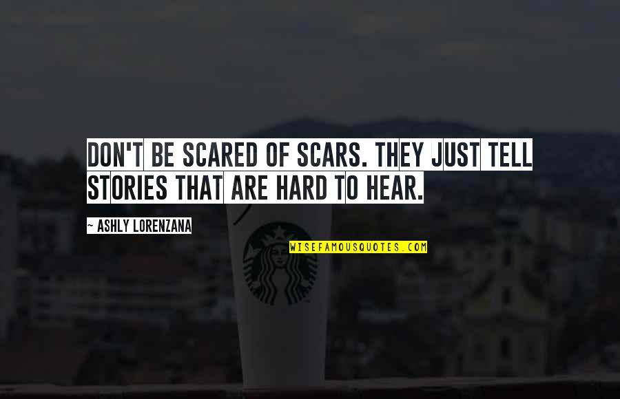 Scared For Life Quotes By Ashly Lorenzana: Don't be scared of scars. They just tell