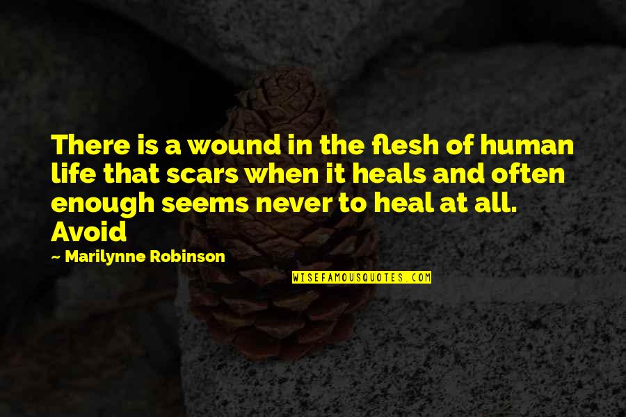 Scars And Life Quotes By Marilynne Robinson: There is a wound in the flesh of