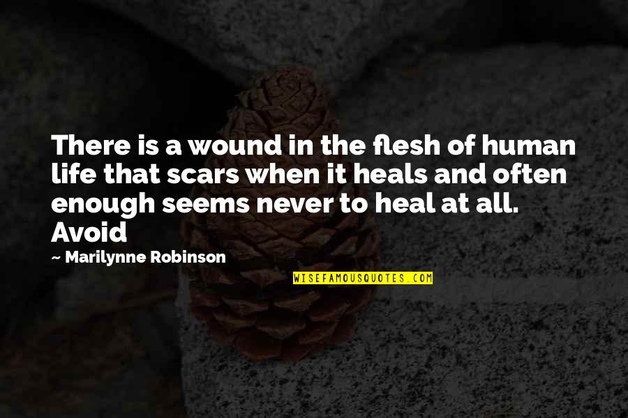 Scars Heal Quotes By Marilynne Robinson: There is a wound in the flesh of