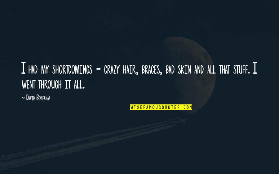 Shortcomings Quotes By David Boreanaz: I had my shortcomings - crazy hair, braces,