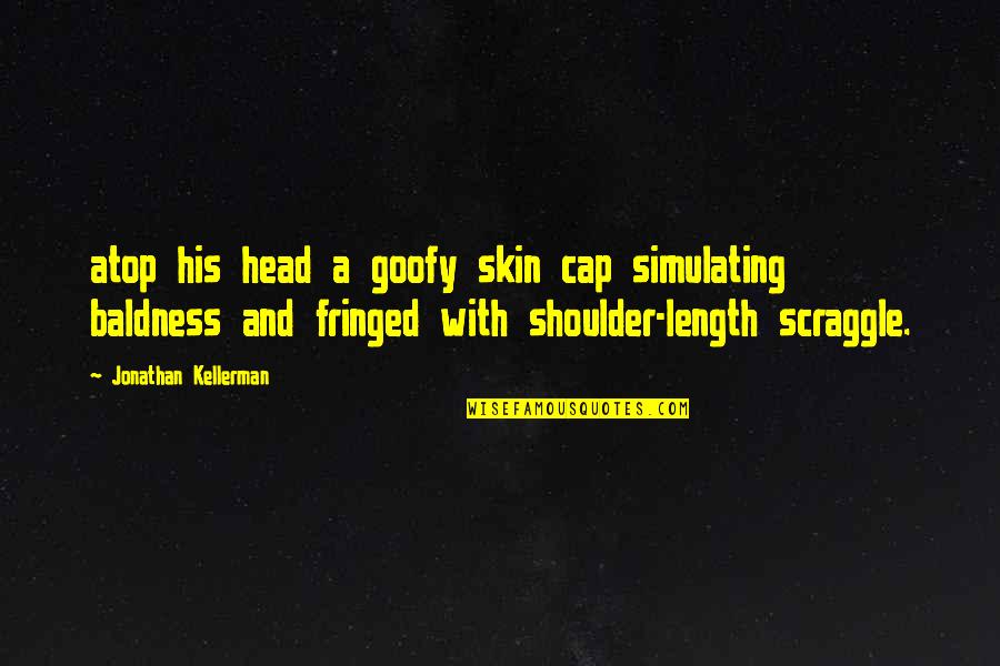 Simulating Quotes By Jonathan Kellerman: atop his head a goofy skin cap simulating