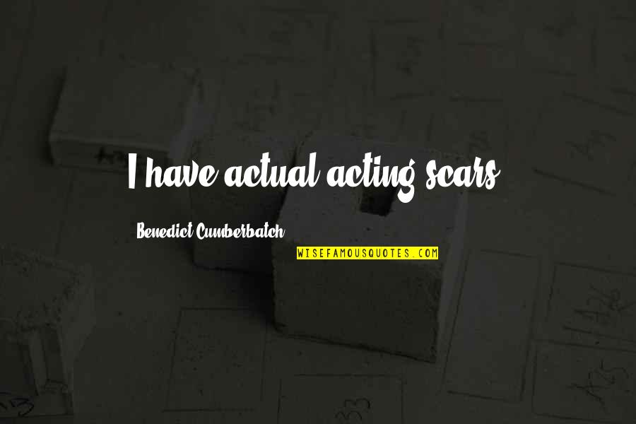 Sir Richard Branson Inspirational Quotes By Benedict Cumberbatch: I have actual acting scars.