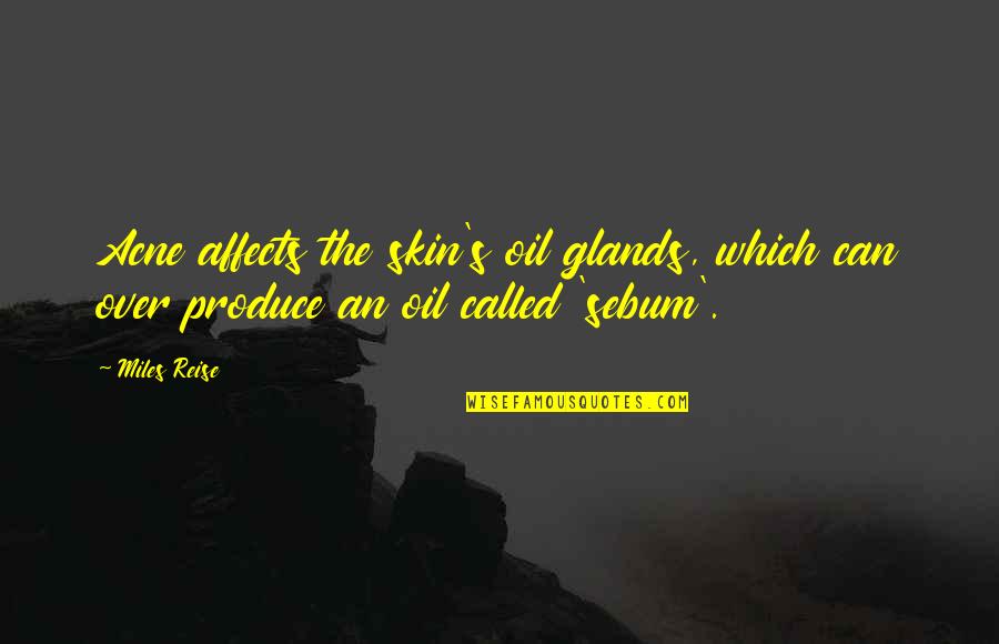 Sisman Sevgilim Quotes By Miles Reise: Acne affects the skin's oil glands, which can