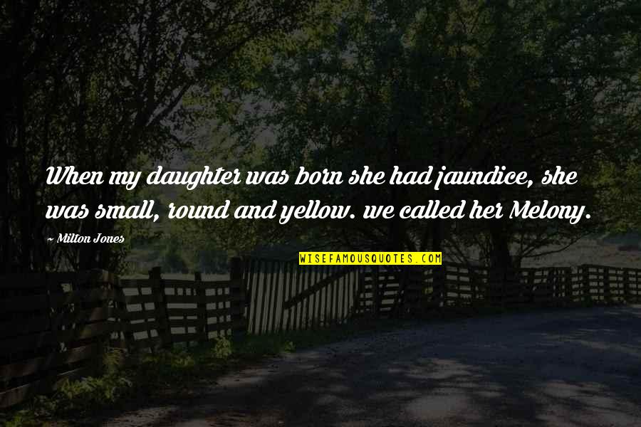 Small Funny Quotes By Milton Jones: When my daughter was born she had jaundice, Small Funny Quotes By Milton Jones: When my daughter was born she had jaundice,