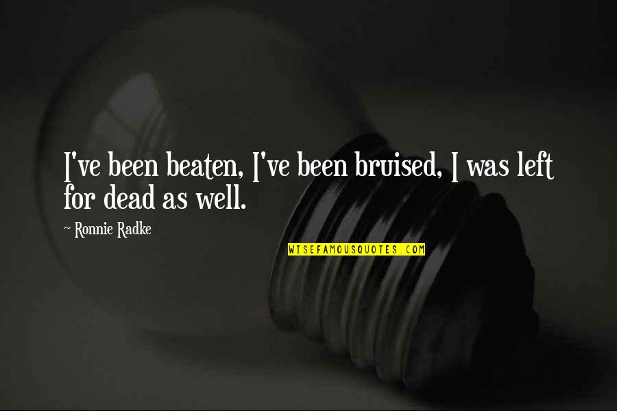 Spireys Quotes By Ronnie Radke: I've been beaten, I've been bruised, I was