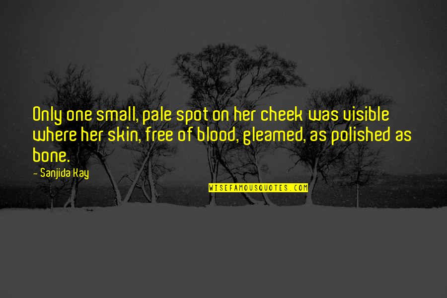 Status Reporting Quotes By Sanjida Kay: Only one small, pale spot on her cheek