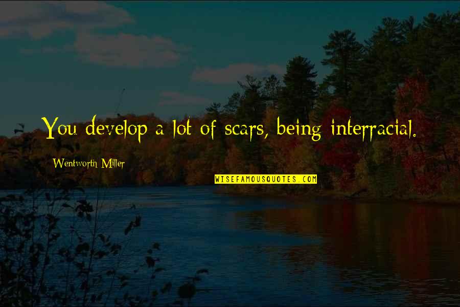 Streamside Camp Quotes By Wentworth Miller: You develop a lot of scars, being interracial. Streamside Camp Quotes By Wentworth Miller: You develop a lot of scars, being interracial.