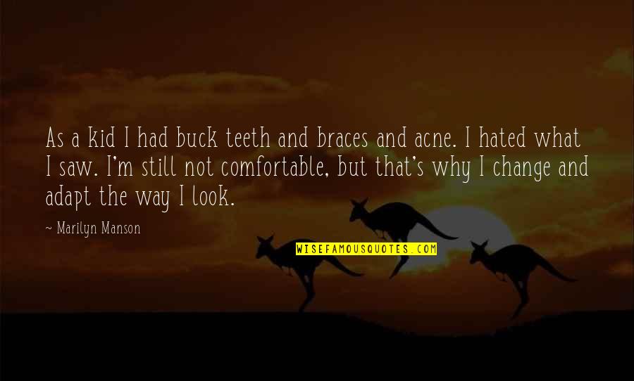 Teeth Braces Quotes By Marilyn Manson: As a kid I had buck teeth and