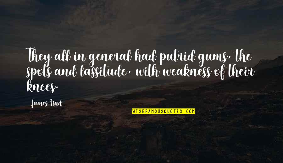 The General Quotes By James Lind: They all in general had putrid gums, the