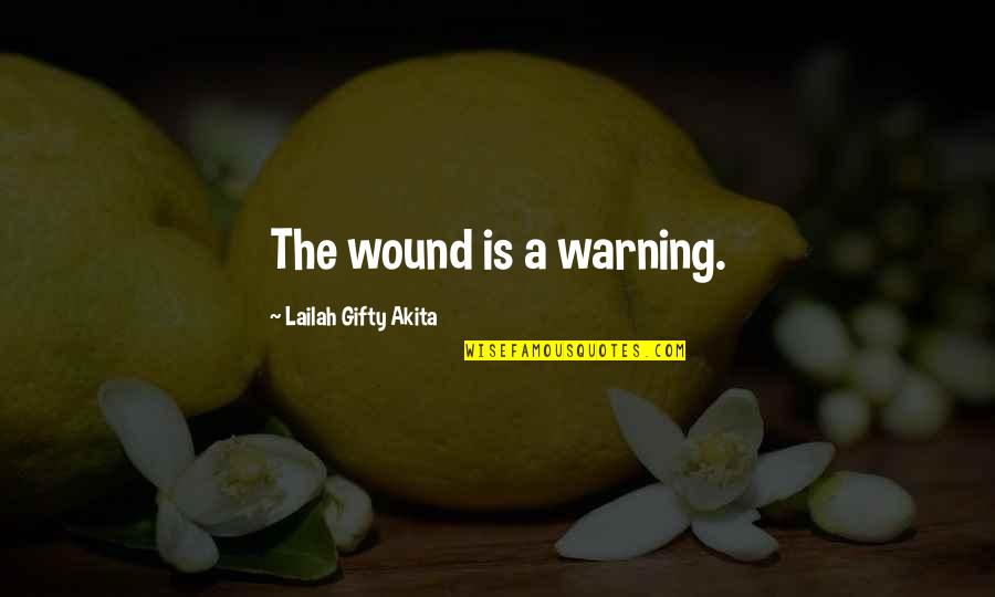 The Homework Myth Quotes By Lailah Gifty Akita: The wound is a warning.