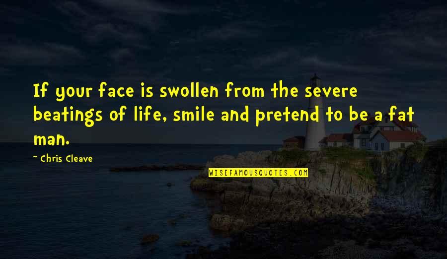 The Man Of Your Life Quotes By Chris Cleave: If your face is swollen from the severe The Man Of Your Life Quotes By Chris Cleave: If your face is swollen from the severe