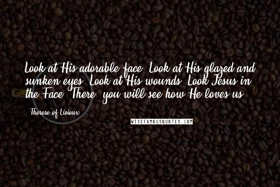 Therese Of Lisieux quotes: Look at His adorable face. Look at His glazed and sunken eyes. Look at His wounds. Look Jesus in the Face. There, you will see how He loves us.