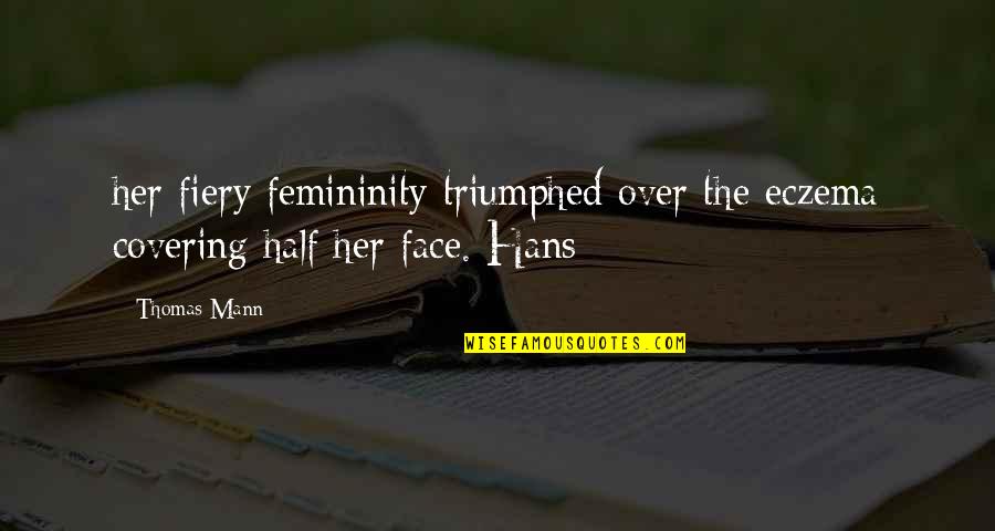 Triumphed Quotes By Thomas Mann: her fiery femininity triumphed over the eczema covering