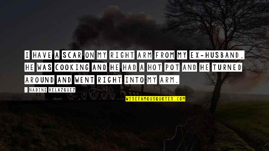 Turned Quotes By Nadine Velazquez: I have a scar on my right arm