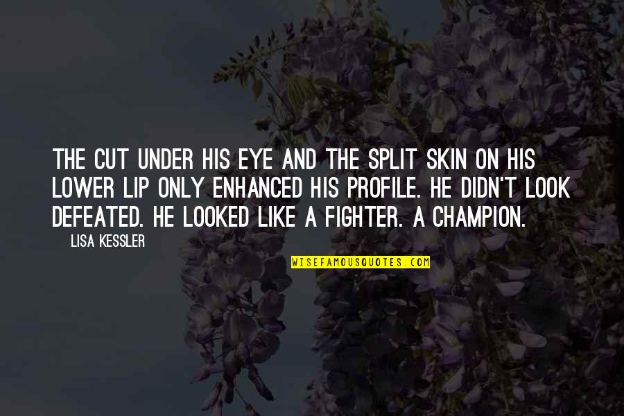 Under Lip Quotes By Lisa Kessler: The cut under his eye and the split