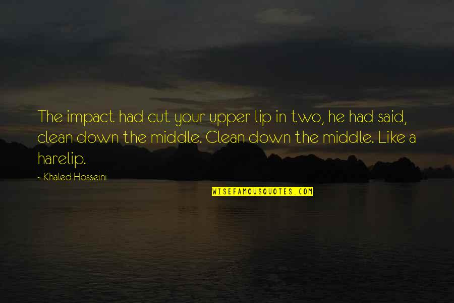 Upper Cut Quotes By Khaled Hosseini: The impact had cut your upper lip in