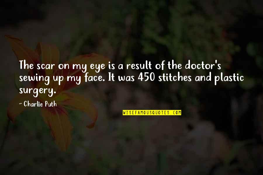 Were In Stitches Quotes By Charlie Puth: The scar on my eye is a result Were In Stitches Quotes By Charlie Puth: The scar on my eye is a result