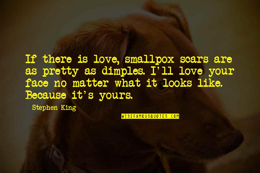 What Love Is Like Quotes By Stephen King: If there is love, smallpox scars are as What Love Is Like Quotes By Stephen King: If there is love, smallpox scars are as