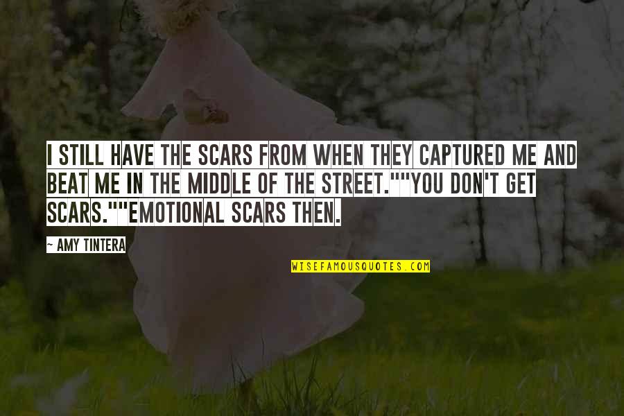 Ya Fiction Quotes By Amy Tintera: I still have the scars from when they