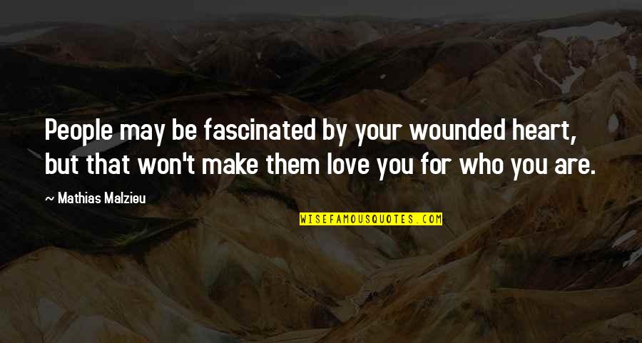You Won My Heart Quotes By Mathias Malzieu: People may be fascinated by your wounded heart,