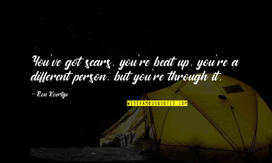 Zwischenr Ume Quotes By Ron Koertge: You've got scars, you're beat up, you're a