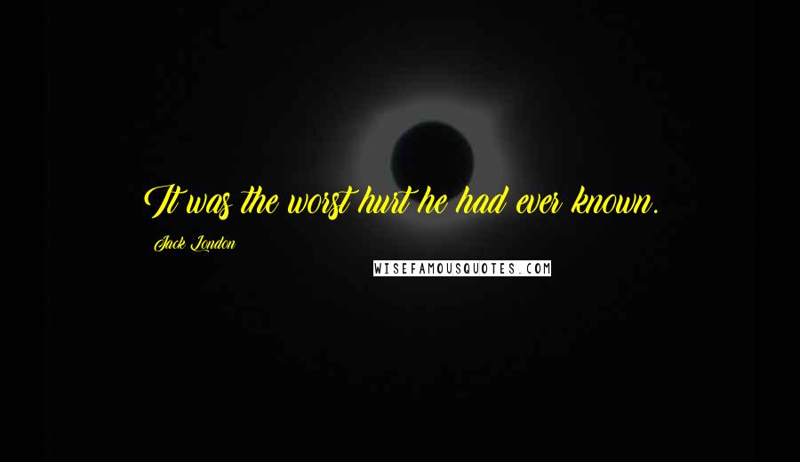 Jack London Quotes: It was the worst hurt he had ever known.