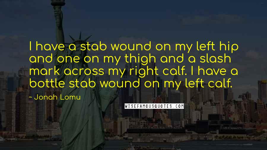 Jonah Lomu Quotes: I have a stab wound on my left hip and one on my thigh and a slash mark across my right calf. I have a bottle stab wound on my left calf.