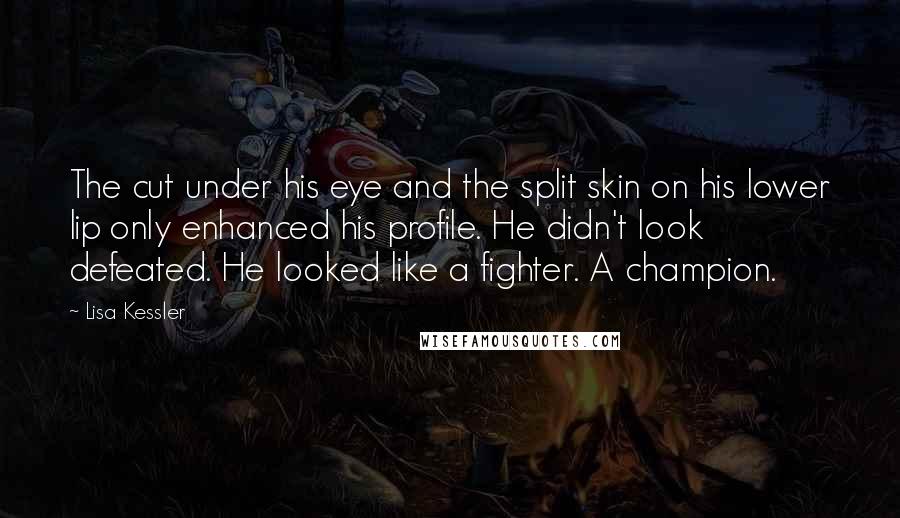 Lisa Kessler Quotes: The cut under his eye and the split skin on his lower lip only enhanced his profile. He didn't look defeated. He looked like a fighter. A champion.