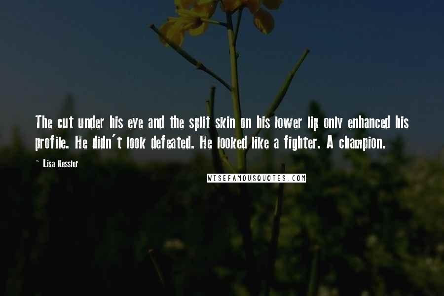 Lisa Kessler Quotes: The cut under his eye and the split skin on his lower lip only enhanced his profile. He didn't look defeated. He looked like a fighter. A champion.