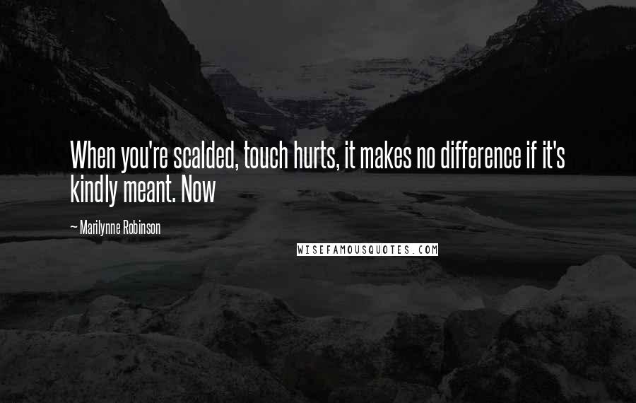 Marilynne Robinson Quotes: When you're scalded, touch hurts, it makes no difference if it's kindly meant. Now