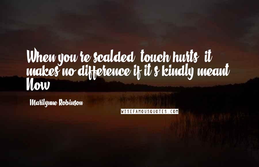 Marilynne Robinson Quotes: When you're scalded, touch hurts, it makes no difference if it's kindly meant. Now